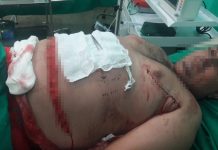 Jovem tenta separar briga e acaba gravemente ferido a golpes de canivete