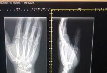 HR de Vilhena orienta pacientes a usar celular para tirar foto de imagens de raio X por “economia e modernidade”; diretor explica