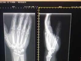 HR de Vilhena orienta pacientes a usar celular para tirar foto de imagens de raio X por “economia e modernidade”; diretor explica