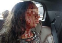 Cão da raça Chow Chow ataca dona no meio da rua em Rondônia