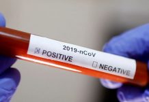 Ouro Preto tem seis casos positivos de covid-19