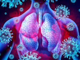 COVID-19: Rondônia tem 314 pacientes internados, 4.942 infectados, 2.157 recuperados e 156 mortes