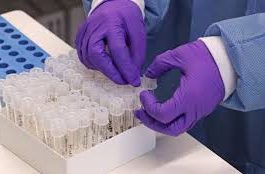 CORONAVÍRUS: Vilhena confirma mais 27 casos nesta segunda, total vai a 162 e 54 novos suspeitos