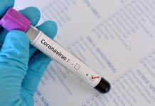 Servidor do Idaron de Vilhena testa positivo para covid-19