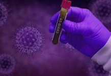 COVID-19: Cerejeiras confirma 32 casos e Pimenteiras 52; veja boletins