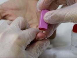 Número de infectados e mortes por coronavírus cai em Rondônia