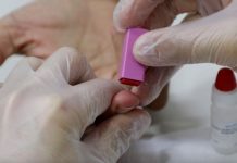 COVID-19: Rondônia registra 5 mortes e 464 novos infectados nas últimas 24 horas