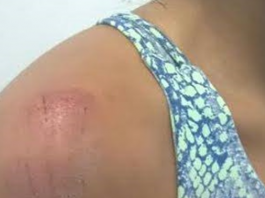 DISCUSSÃO: jovem é espancada a “capacetadas” pelo cunhado dentro de casa