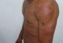 Mulher é presa após se autolesionar para acusar marido de agressão em Porto Velho