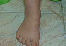 PORTO VELHO: menina de 11 anos denuncia que era estuprada pelo amigo do pai