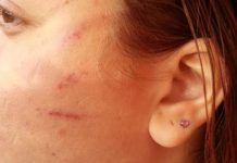 Assaltante dá “tapa na cara” de jovem e rouba celulares em Vilhena