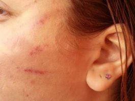 Assaltante dá “tapa na cara” de jovem e rouba celulares em Vilhena