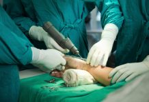 Agevisa recolhe ferramentas usadas para cirurgia ortopédica e procedimentos são suspensos no HR de Vilhena