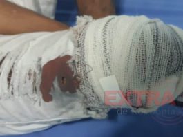 Homem é baleado em roda de amigos em Colorado