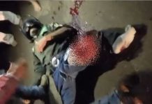 Motociclista é socorrido após cair em quebra-molas em Cabixi