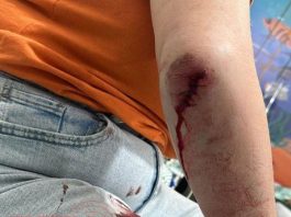 VÍDEO: morador de rua que atacou mulher em praça é o mesmo que provocou incêndio às margens da BR em Vilhena; foi detido e liberado