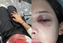 VÍDEO: ex-moradora de Vilhena é agredida por homem após esbarrar nele em Ji-Paraná