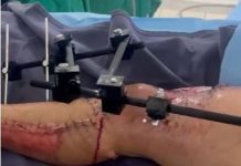 CORUMBIARA: vídeo de cirurgia em criança vazado por equipe de saúde gera indignação e deve resultar em investigação