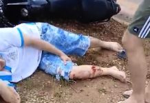 VÍDEO: motociclista sofre fratura exposta em acidente com carro numa das principais avenidas de Vilhena